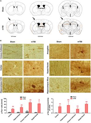 Corrigendum: Long-Term Cognitive Impairments and Pathological Alterations in a Mouse Model of Repetitive Mild Traumatic Brain Injury